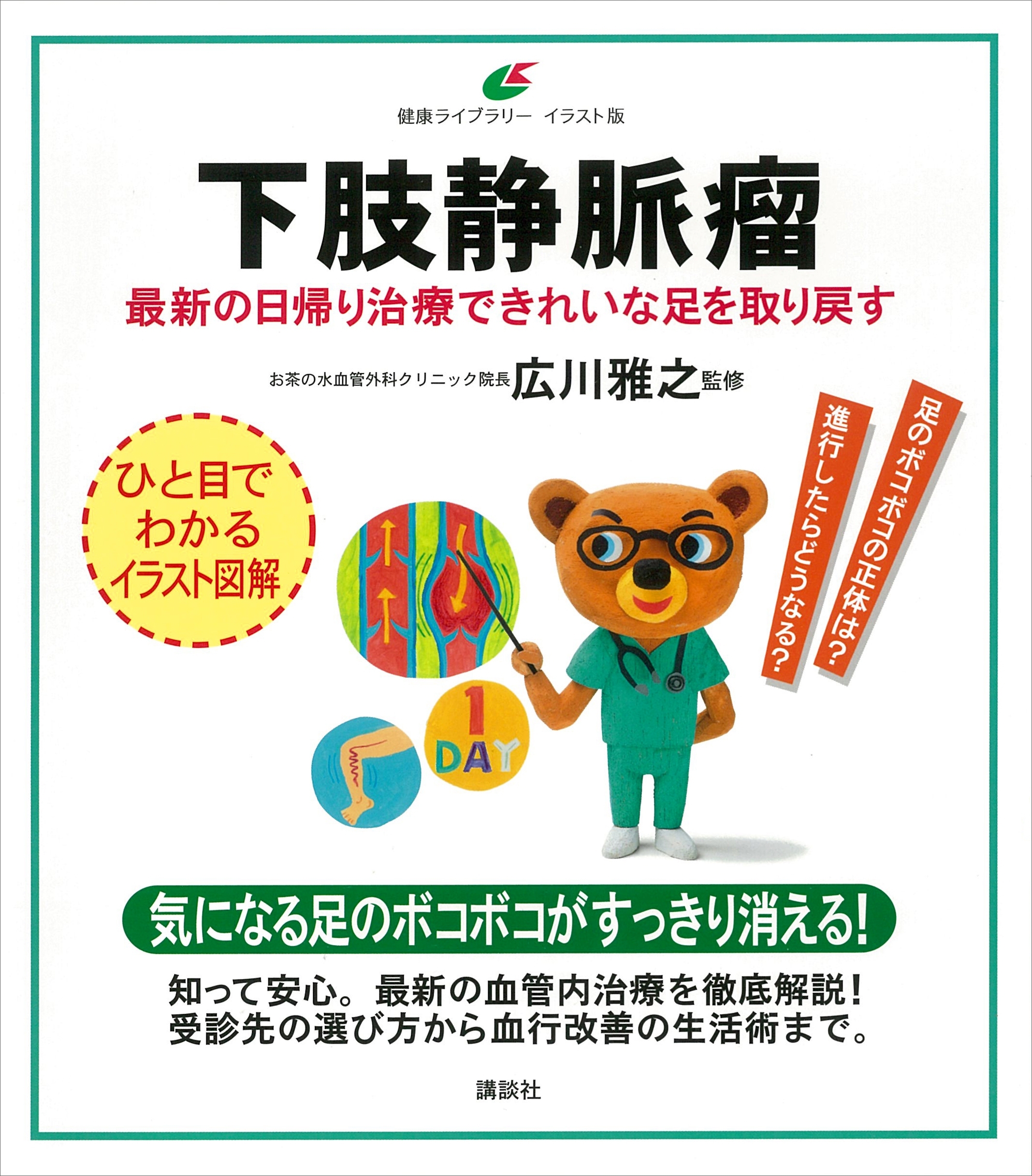 下肢静脈瘤　最新の日帰り治療できれいな足を取り戻す