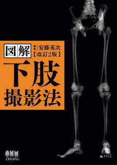 図解 下肢撮影法 (改訂2版)