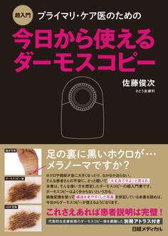 超入門 プライマリ・ケア医のための今日から使えるダーモスコピー