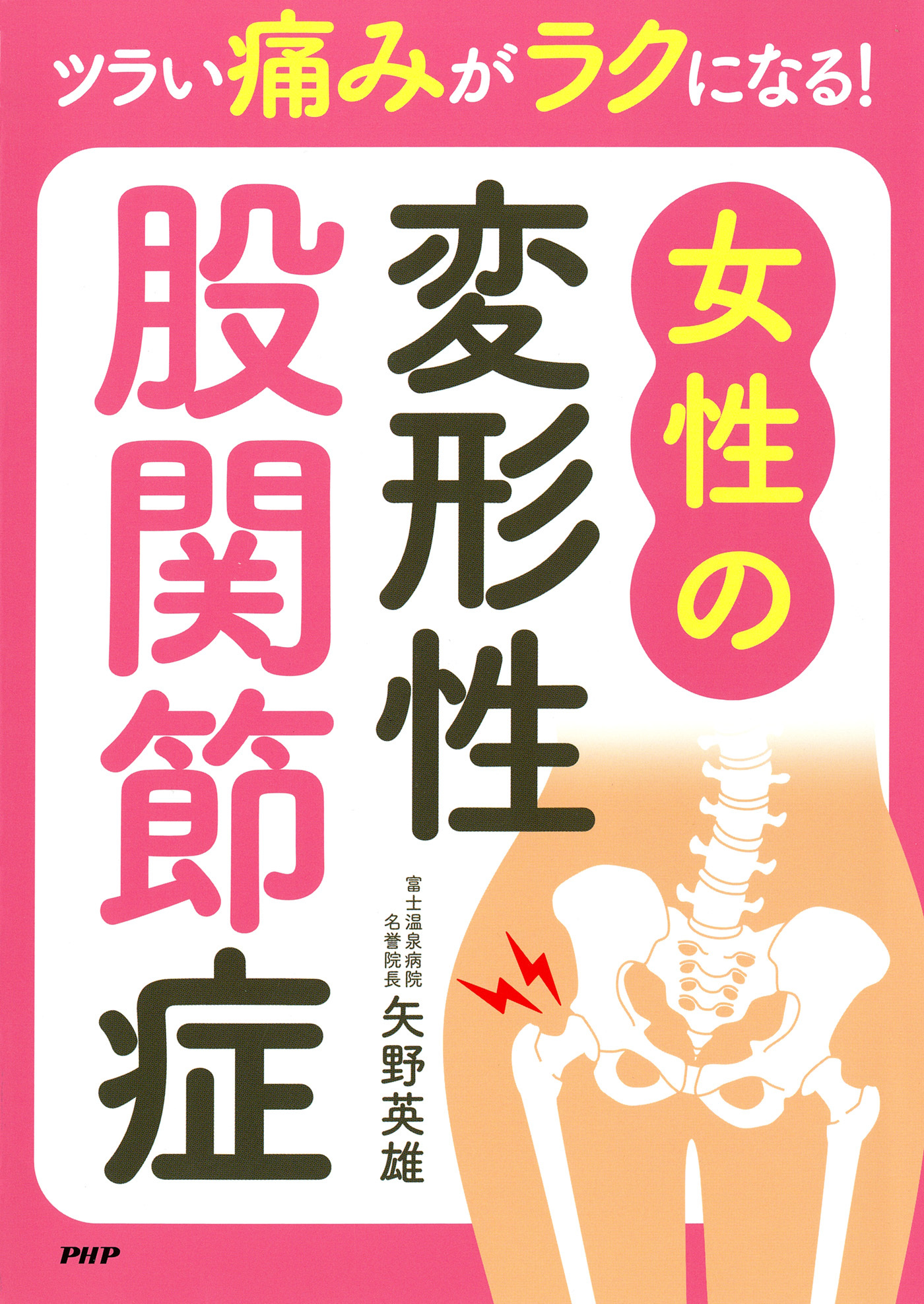 ツラい痛みがラクになる！ 女性の変形性股関節症