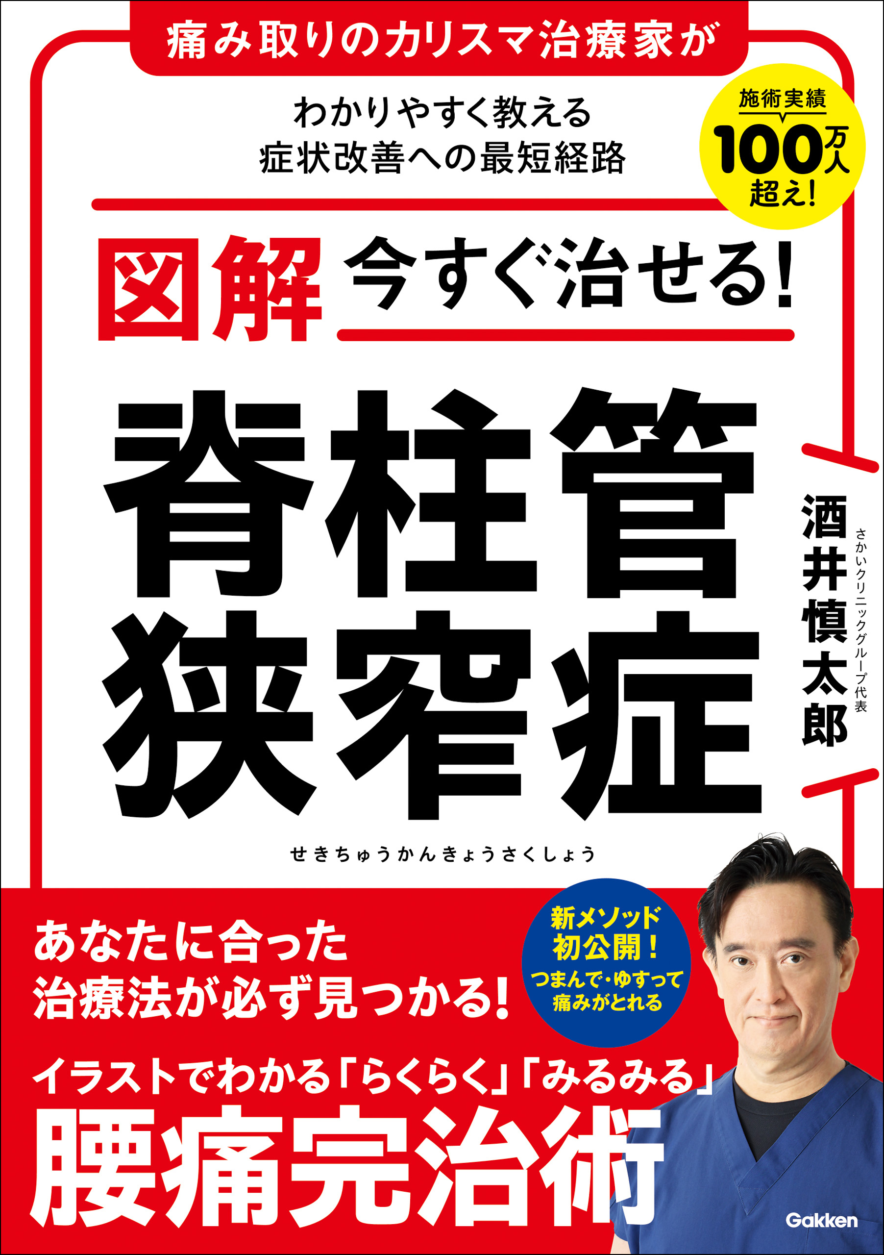 図解 今すぐ治せる！ 脊柱管狭窄症