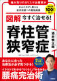 図解 今すぐ治せる! 脊柱管狭窄症