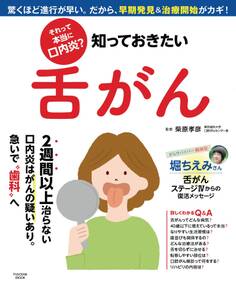 それって本当に口内炎? 知っておきたい舌がん
