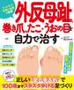 外反母趾、巻き爪、たこ・うおの目を自力で治す