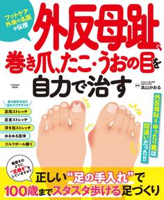 外反母趾、巻き爪、たこ・うおの目を自力で治す