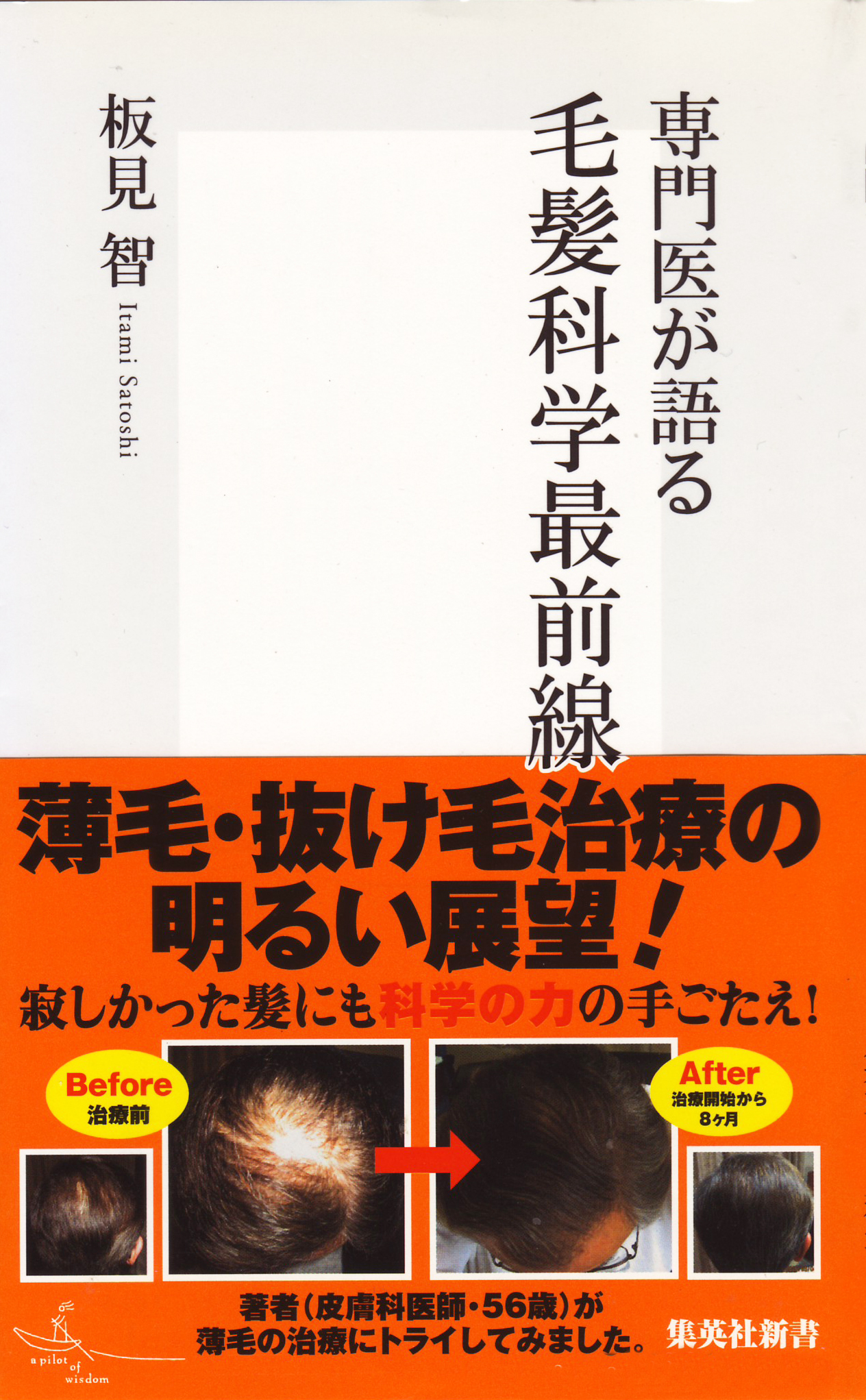 専門医が語る　毛髪科学最前線