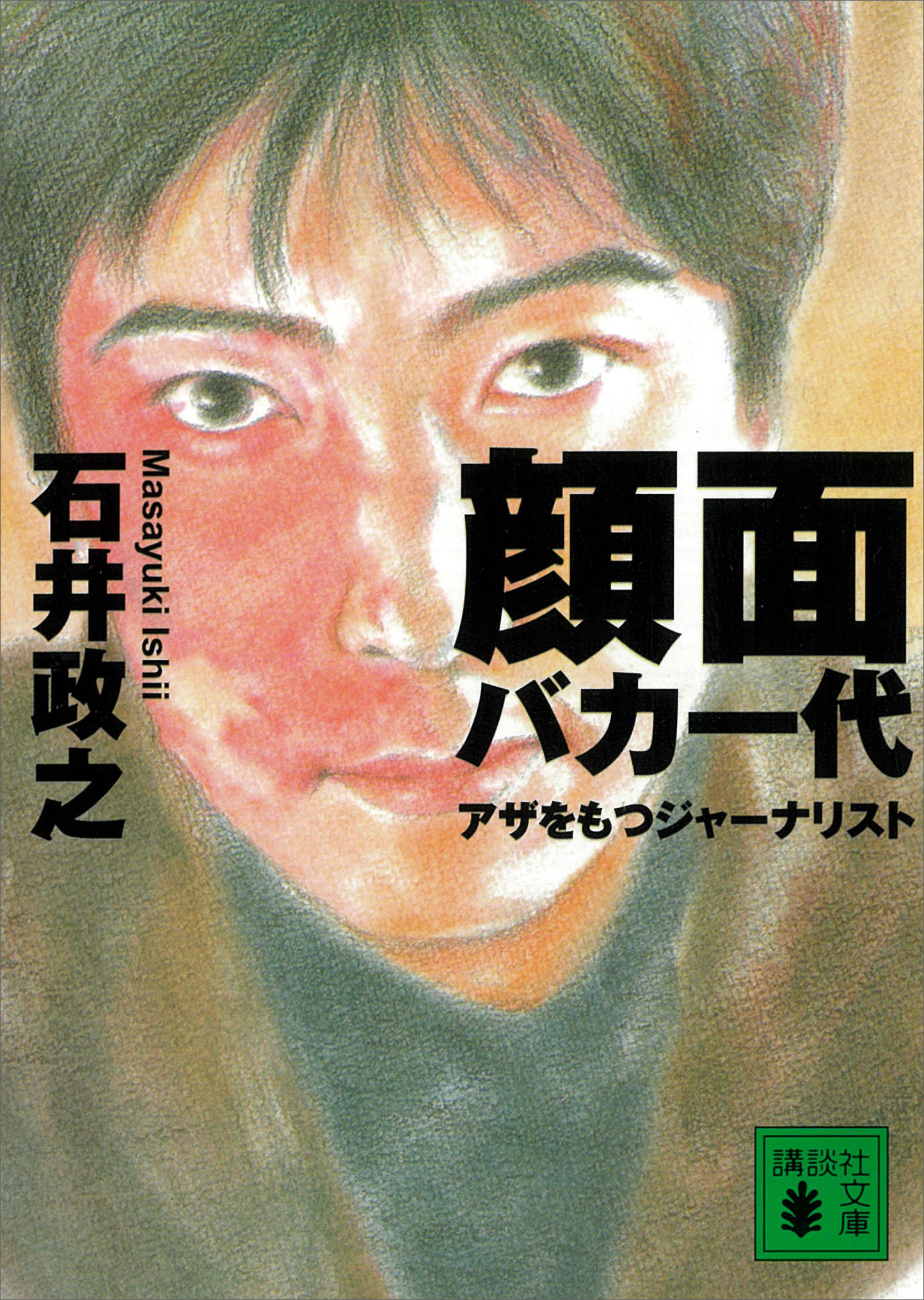 顔面バカ一代　アザをもつジャーナリスト