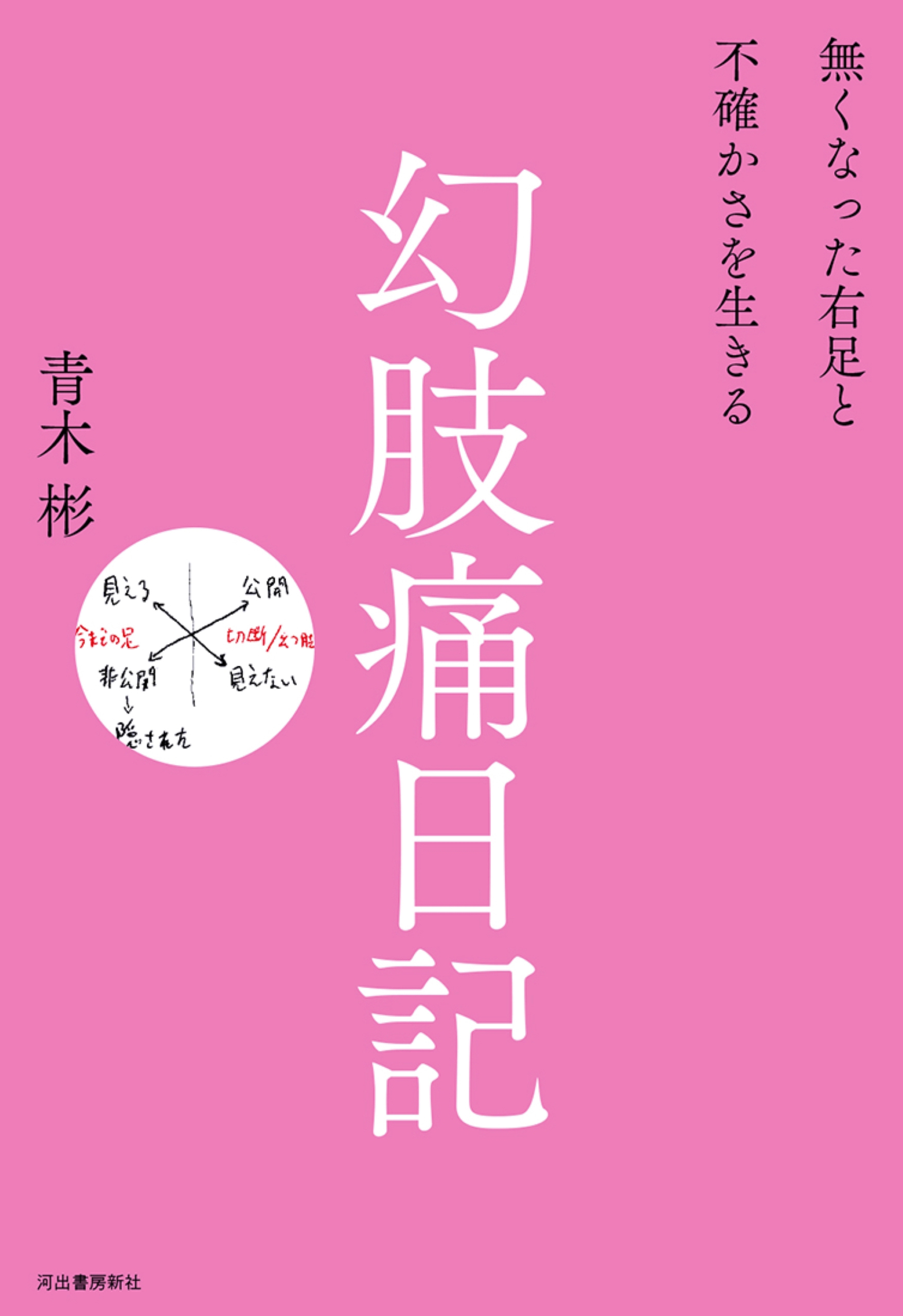 幻肢痛日記　無くなった右足と不確かさを生きる