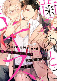 噛みあとにキス