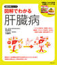 図解でわかる肝臓病