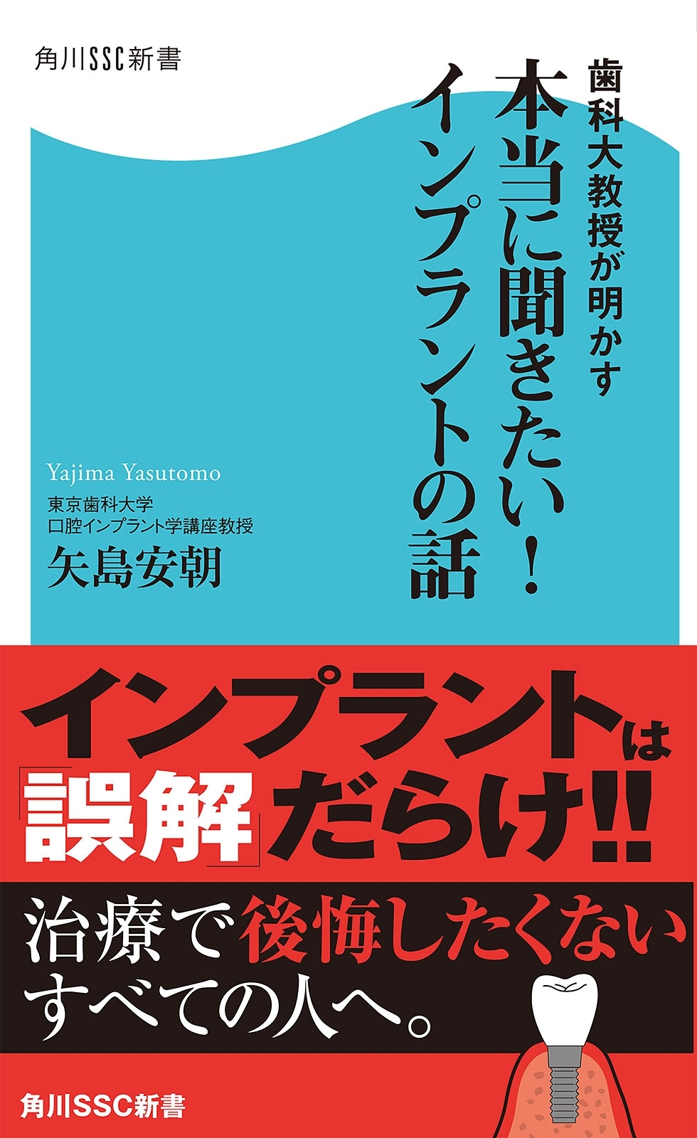歯科大教授が明かす　本当に聞きたい！インプラントの話