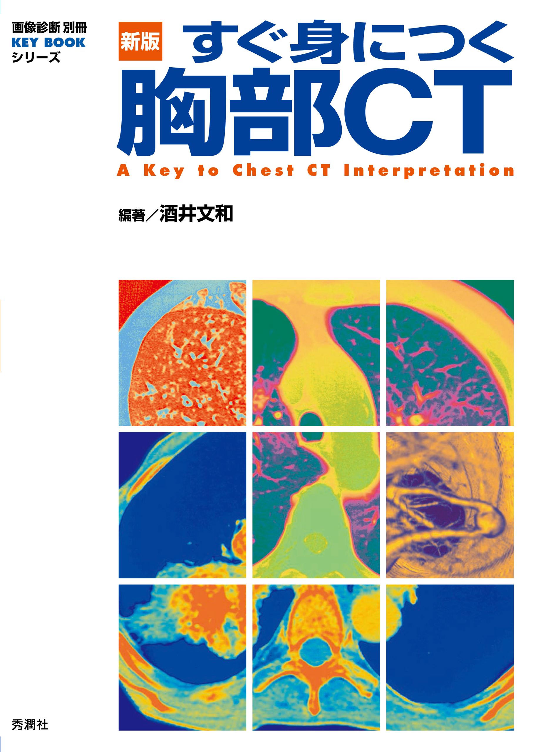 新版 すぐ身につく胸部 CT
