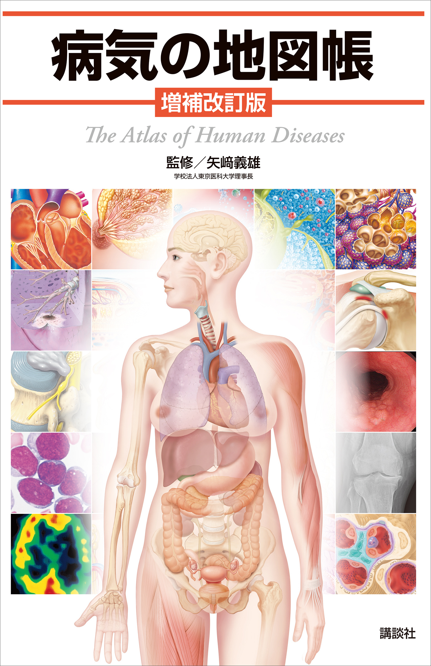 病気の地図帳　増補改訂版