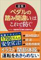 【図解】「ペダルの踏み間違い」はこれで防ぐ