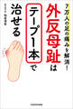 7万人の足の痛みを解消! 外反母趾はテープ1本で治せる