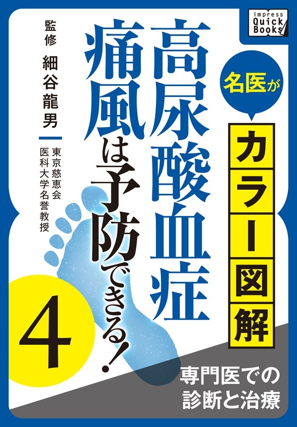 名医がカラー図解！ 高尿酸血症・痛風は予防できる！ (4) 専門医での診断と治療