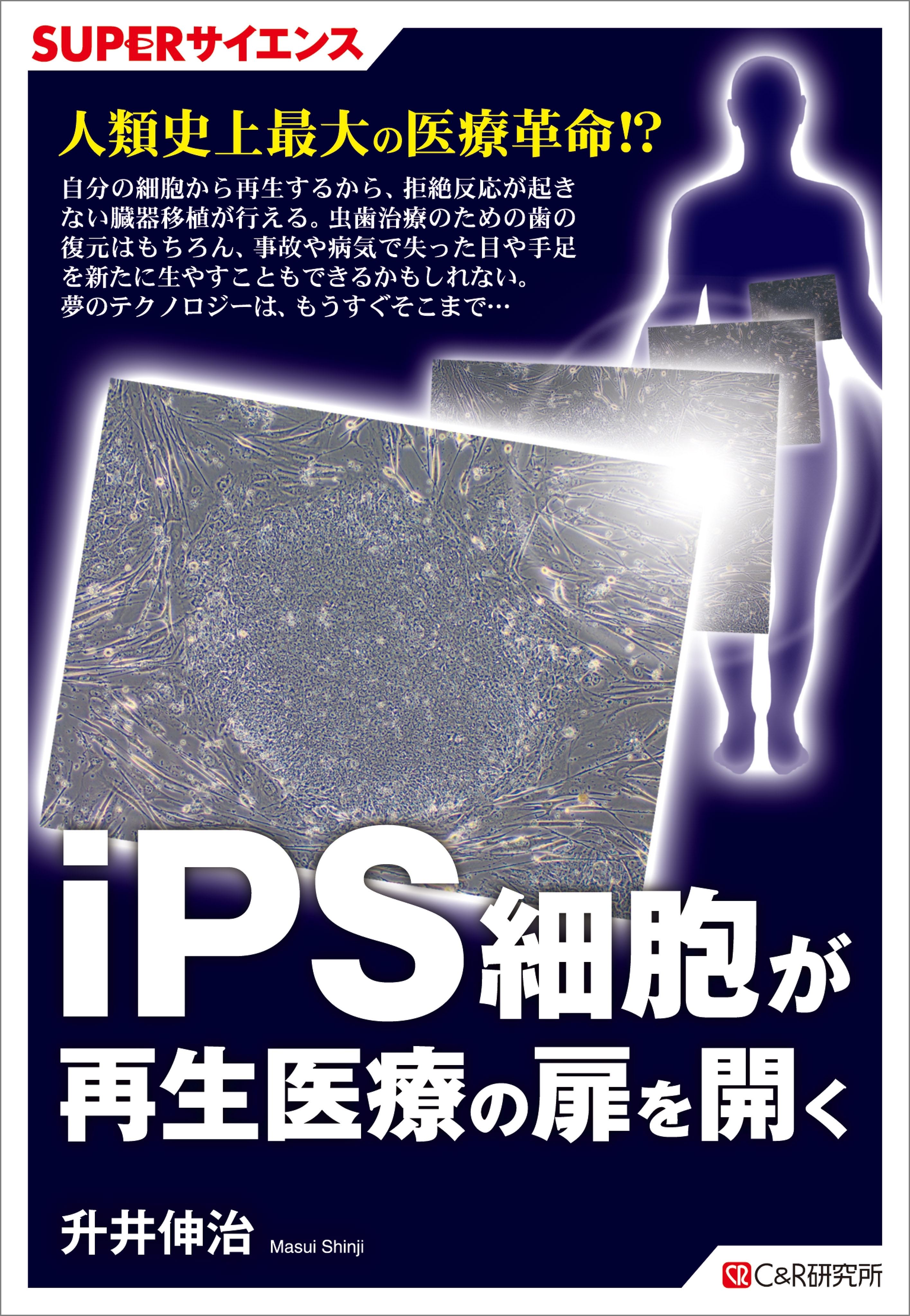 SUPERサイエンス　iPS細胞が再生医療の扉を開く