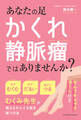 あなたの足、かくれ静脈瘤ではありませんか?