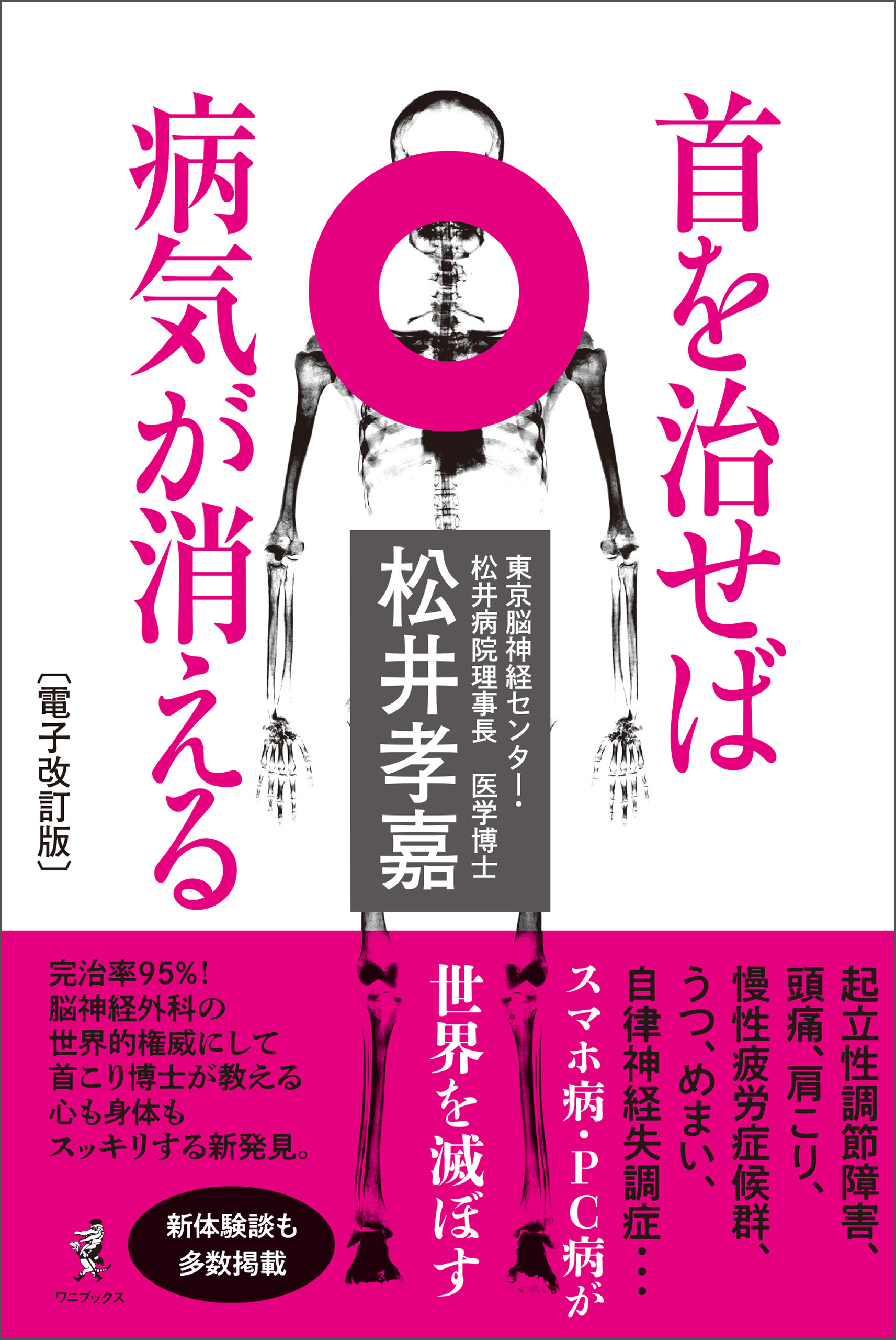 首を治せば病気が消える［電子改訂版］