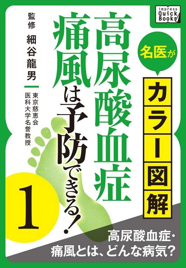 名医がカラー図解！ 高尿酸血症・痛風は予防できる！ (1) 高尿酸血症・痛風とは、どんな病気？
