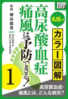 名医がカラー図解! 高尿酸血症・痛風は予防できる! (1) 高尿酸血症・痛風とは、どんな病気?