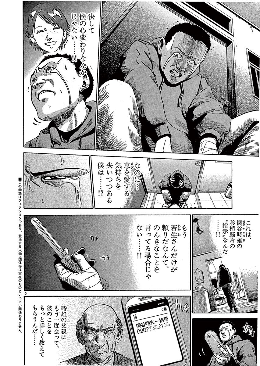 完了しました 脳 移植 漫画