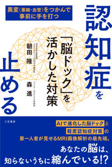 認知症を止める 「脳ドック」を活かした対策
