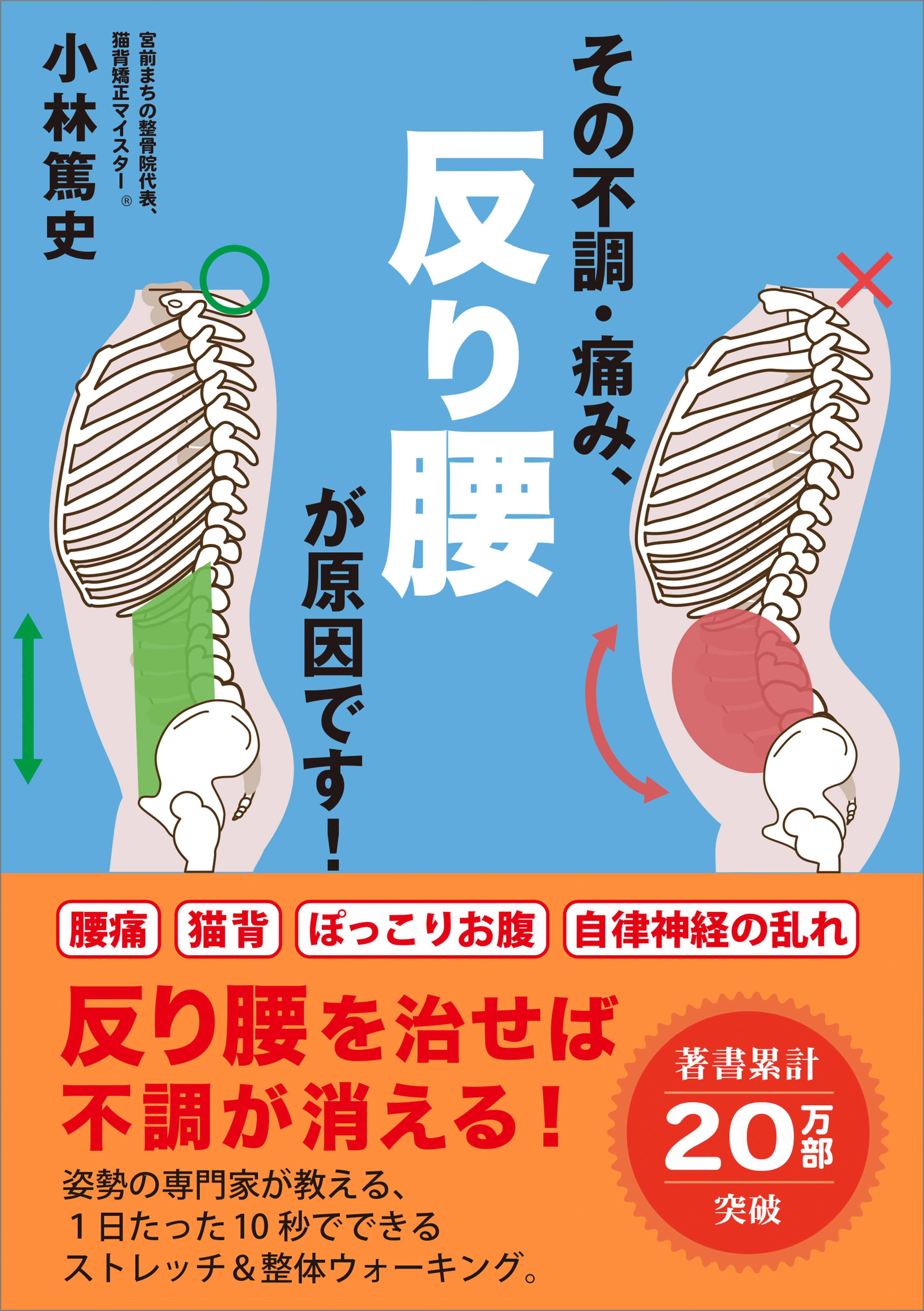 その不調・痛み、反り腰が原因です！