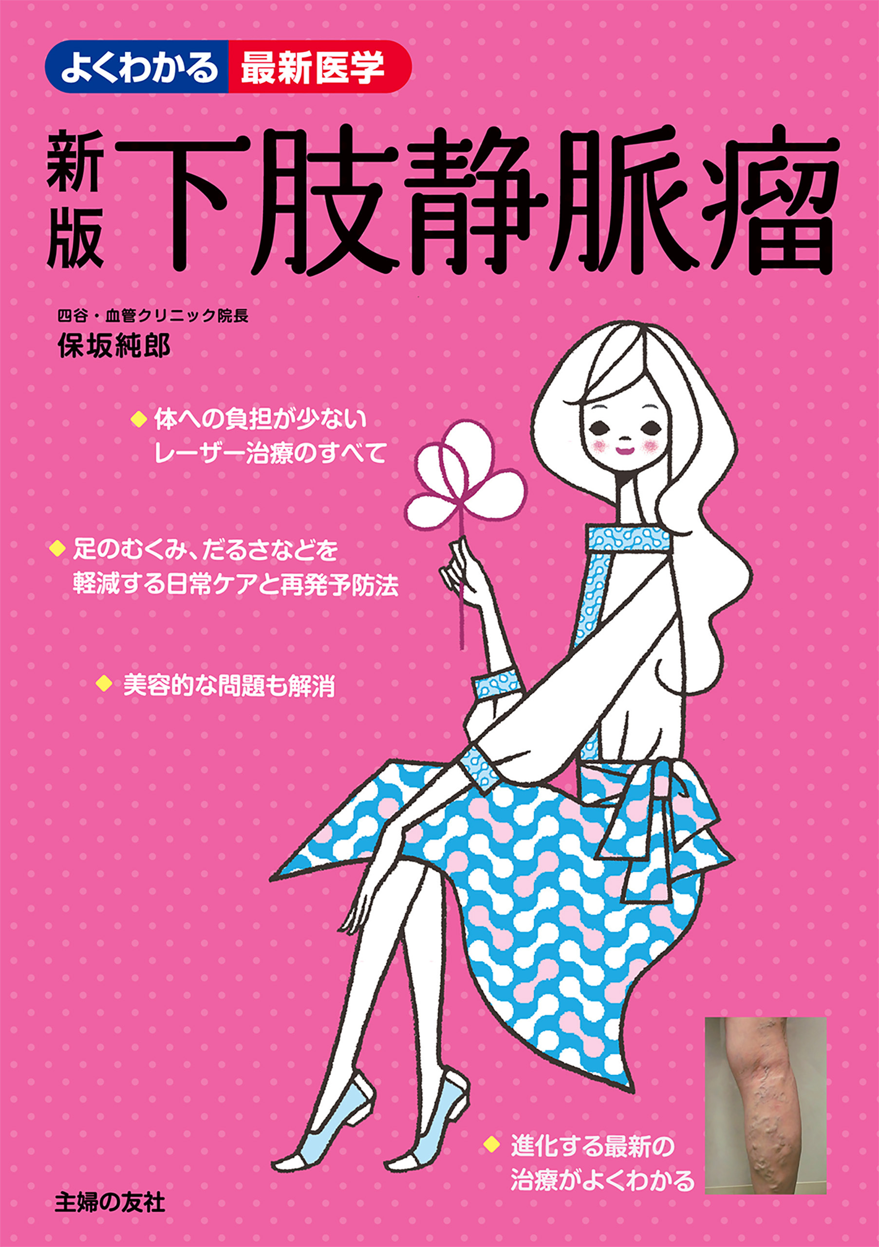 新版　下肢静脈瘤