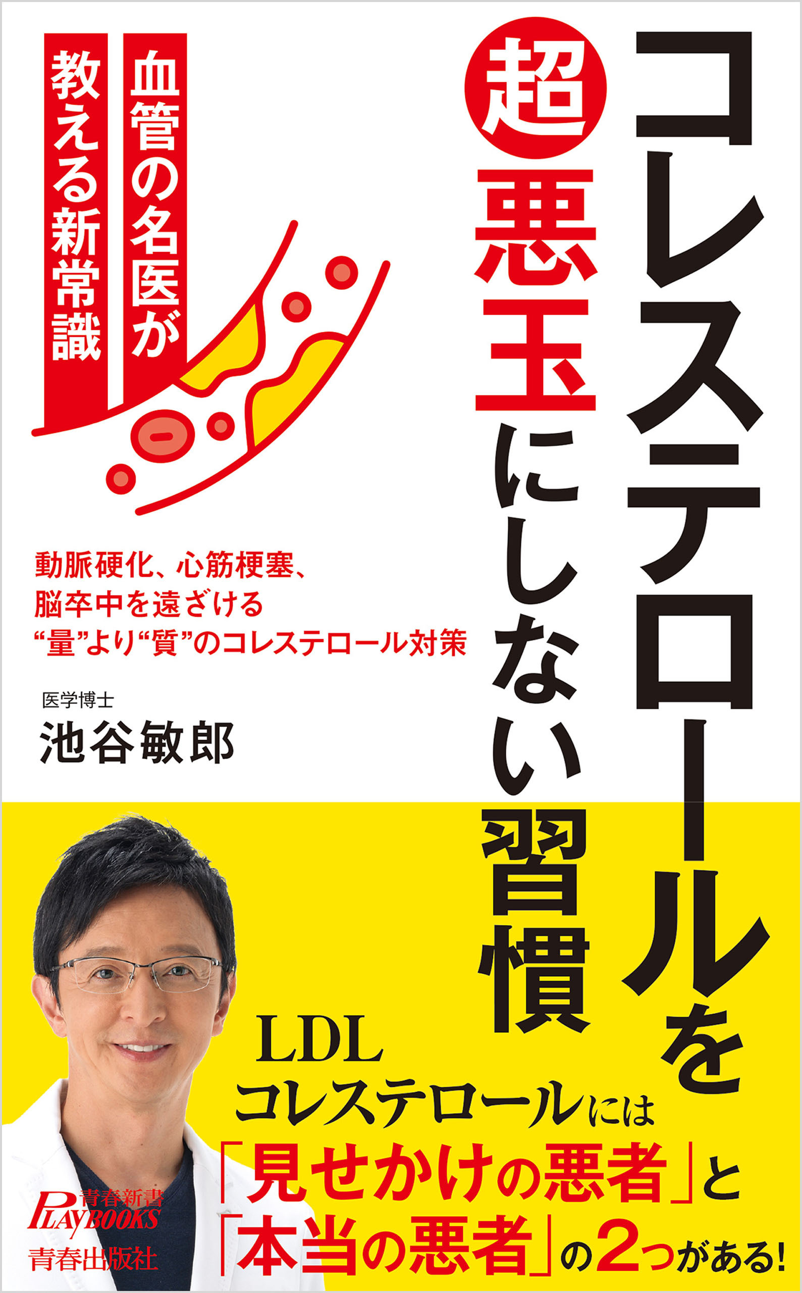 コレステロールを超悪玉にしない習慣