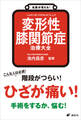 名医が答える! 変形性膝関節症 治療大全